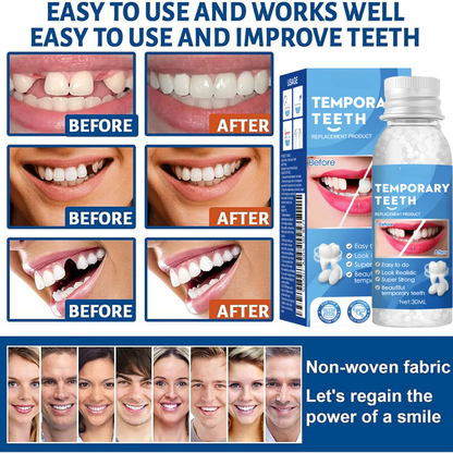 🔥LAST DAY 80% OFF🔥 Temporary Molding Denture-Tooth Repair