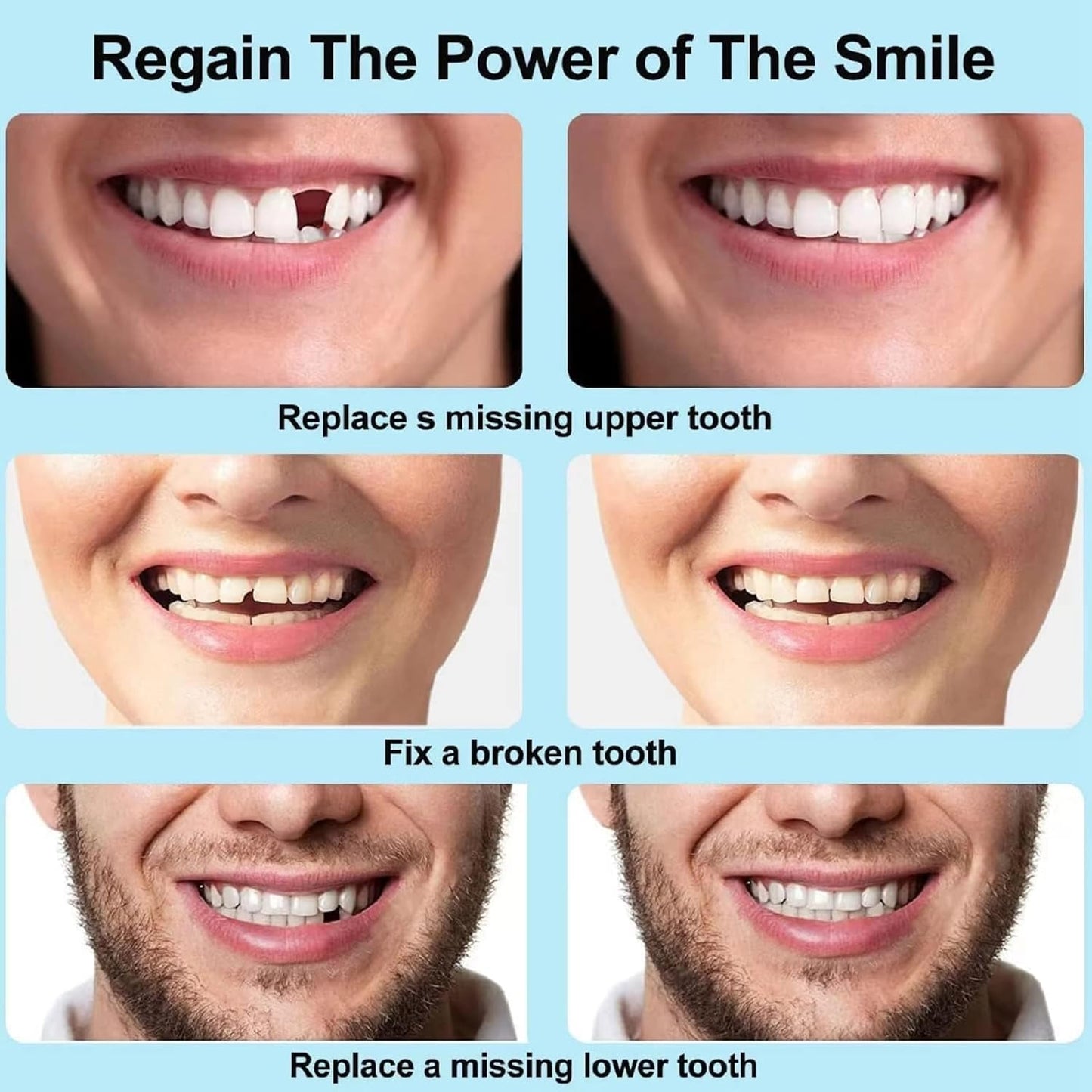 🔥LAST DAY 80% OFF🔥 Temporary Molding Denture-Tooth Repair