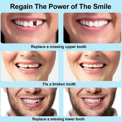 🔥LAST DAY 80% OFF🔥 Temporary Molding Denture-Tooth Repair