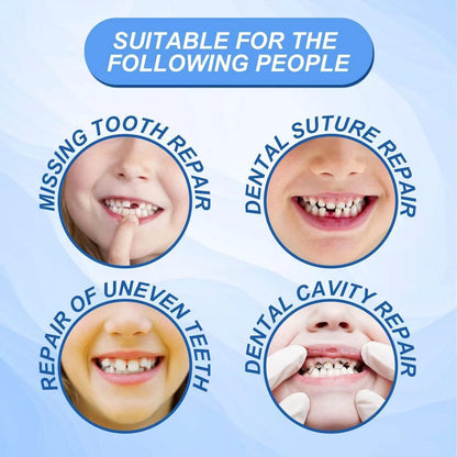 🔥LAST DAY 80% OFF🔥 Temporary Molding Denture-Tooth Repair